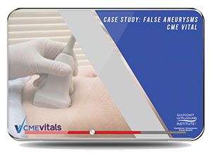 Case Study: False Aneurysms